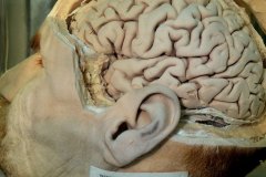 Preparado que muestra una porción de cerebro y sus surcos